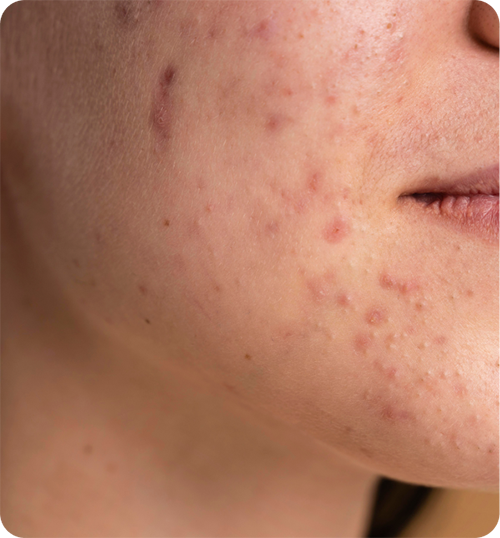 Aesthetic laser clinic singapore