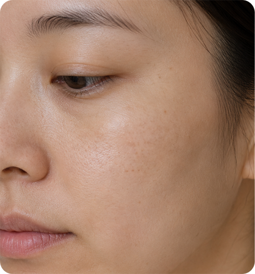 pigmentation 