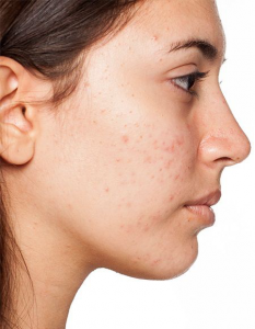 treatment2.jpg treatment2.jpg